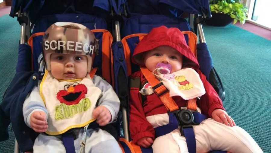 When Should a Baby Wear a Helmet?