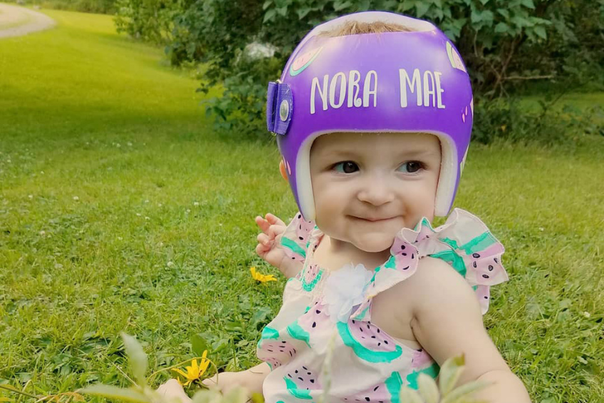 What Situations Require a Baby to Wear a Helmet?