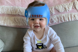 Why Do Some Babies Wear Helmets?